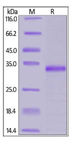 SDS-PAGE (JAK1-938H).jpg